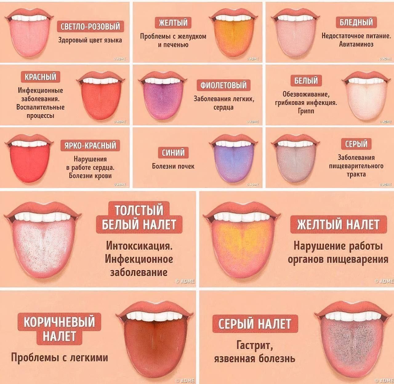 Диагноз по языку в картинках